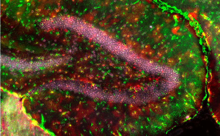 Hybrid Brain Cell Unil and Wyss Center