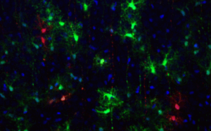 Unige Astrocytes