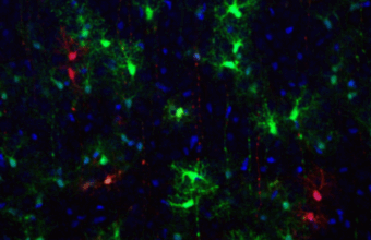 Unige Astrocytes