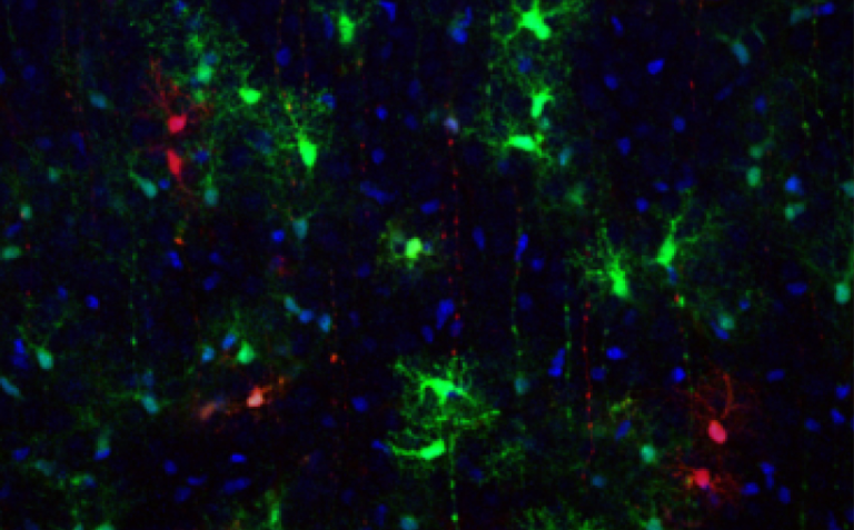 Unige Astrocytes