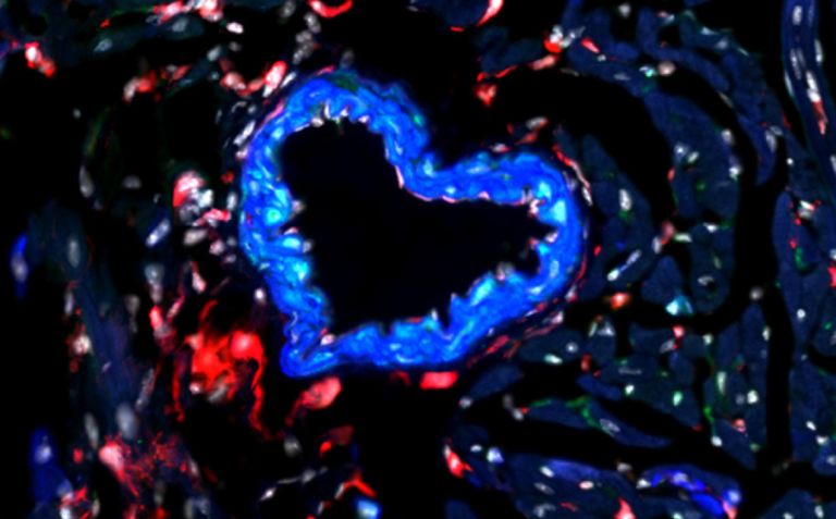 Geneva Centre for Cardiac and Vascular Research (GCCVR)