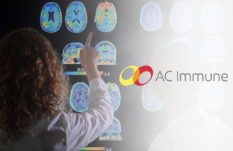 AC immune