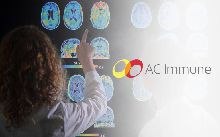 AC immune